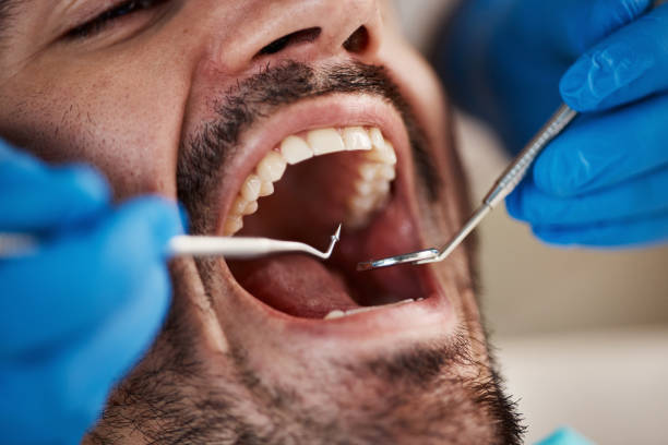 Best Weekend Emergency Dentist in Kutztown University, PA