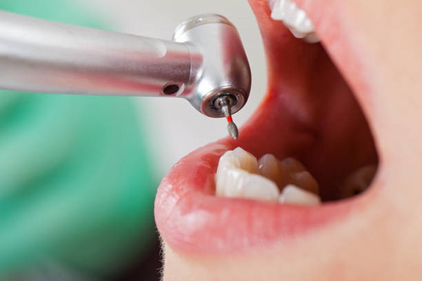 Best Emergency Tooth Extraction in Kutztown University, PA